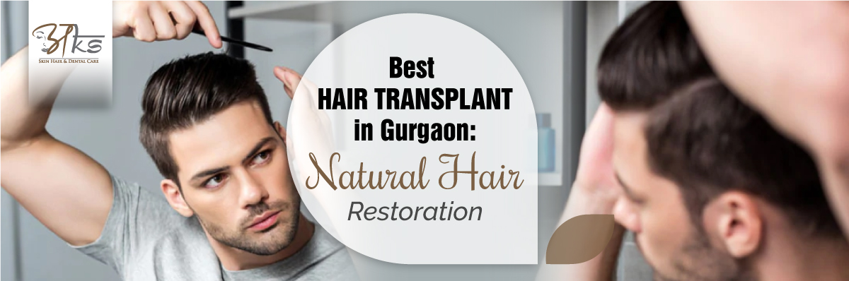 Best Hair Transplant in Gurgaon: Natural Hair Restoration