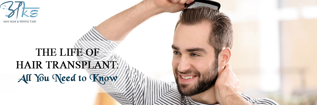The Life of Hair Transplant