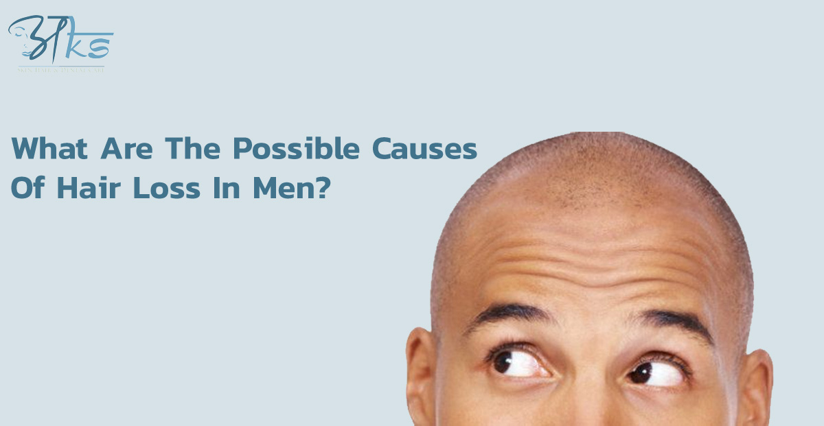  Possible Causes Of Hair Loss In Men