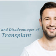 Hair Transplant Surgery