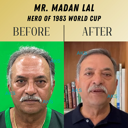 AKS clinic Before and After 2