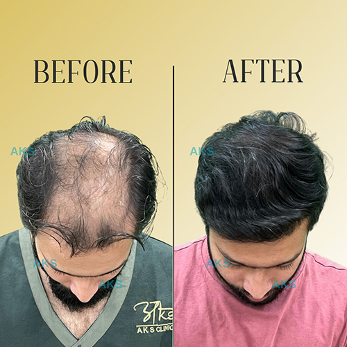 AKS clinic Before and After 8