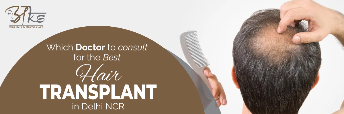 Best Doctor to Consult for Hair Transplant in Delhi NCR