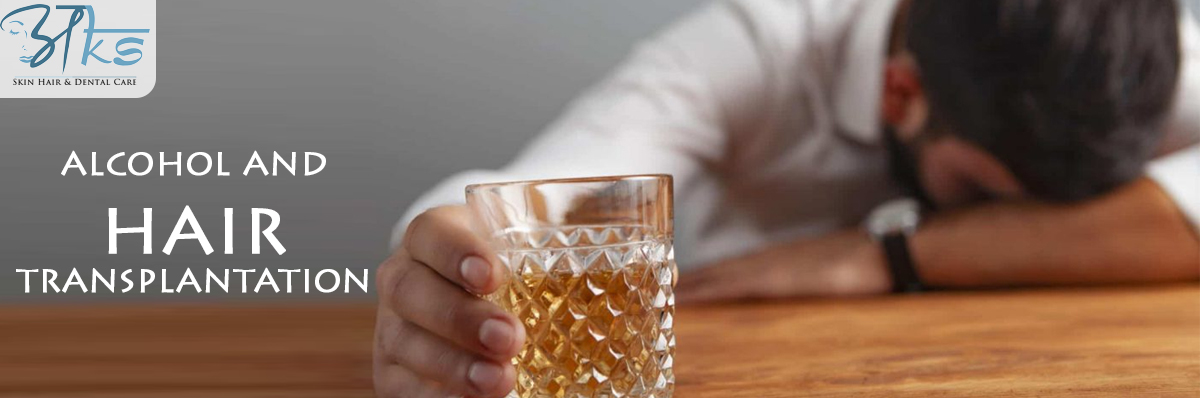 Alcohol and Hair Transplantation Alcohol and Hair Transplantation in Delhi