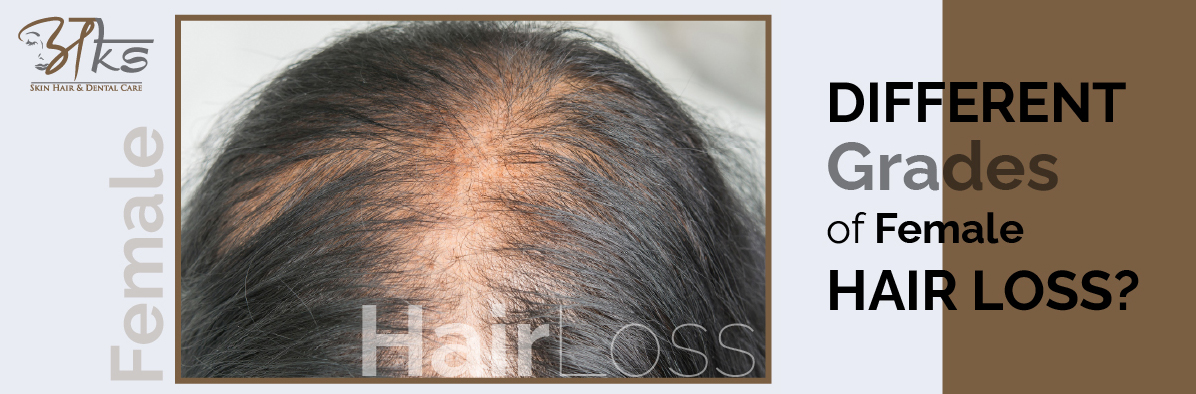 Why Choose a Reputed Hair Transplant Clinic in Gurgaon