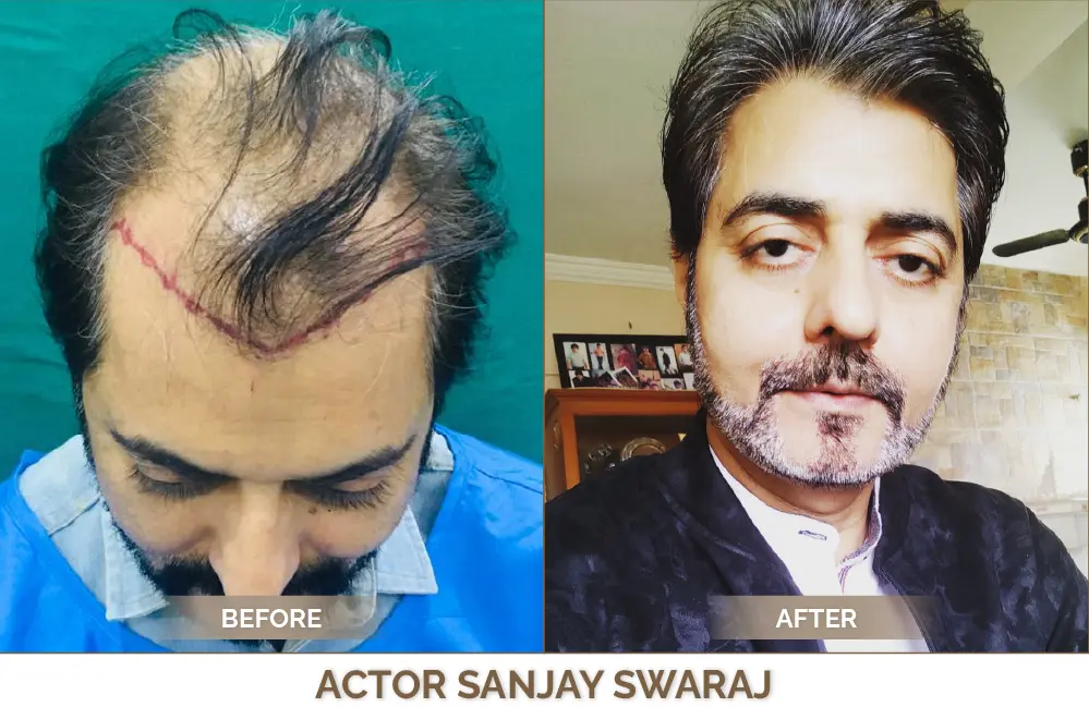 Celebrity Hair hair treatment Celebrity Hair TREATMENT