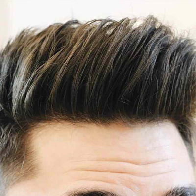 Hair Loss Treatment Hair Loss Treatment