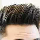 Hair Loss Treatment Hair Loss Treatment
