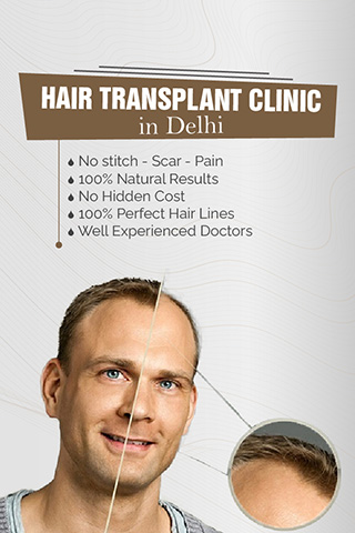 hair transplant delhi clinic