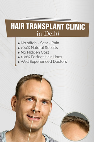 Best Hair Transplant Doctor in Delhi  Hair Treatment Clinic DelhiNCR