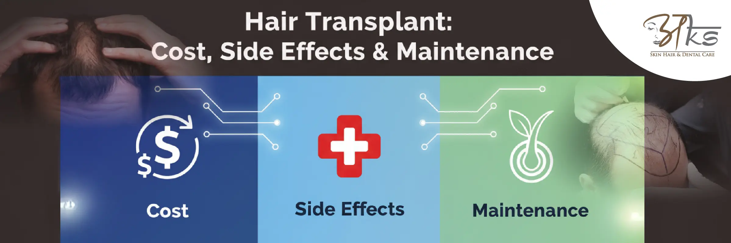 Hair Transplant Cost, Side Effects & Maintenance Hair Transplant Cost