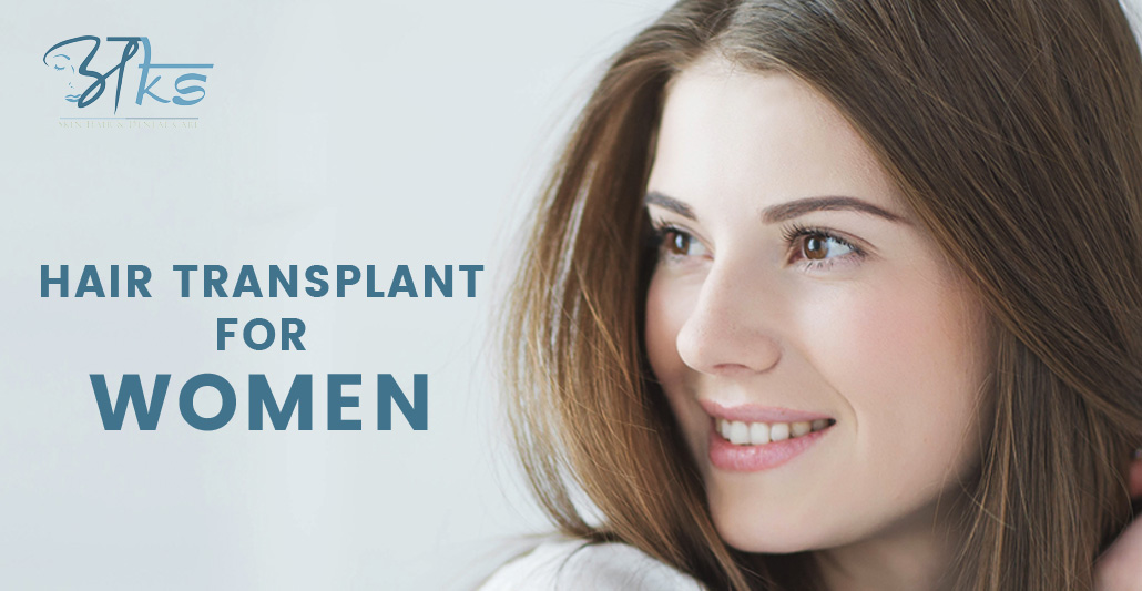 Hair Transplant for Women