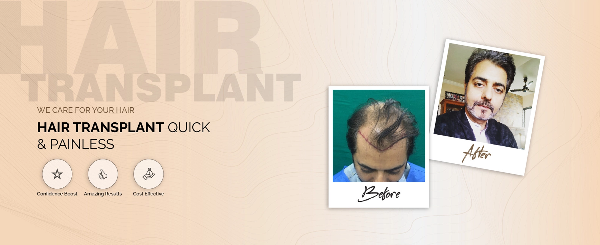 Hair Transplant Doctor Near Me