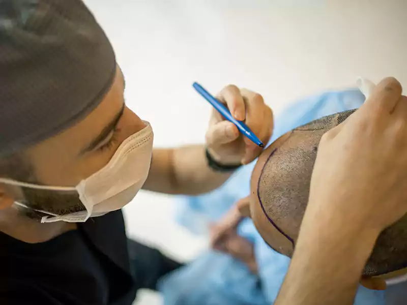 Hair Transplant Surgeon