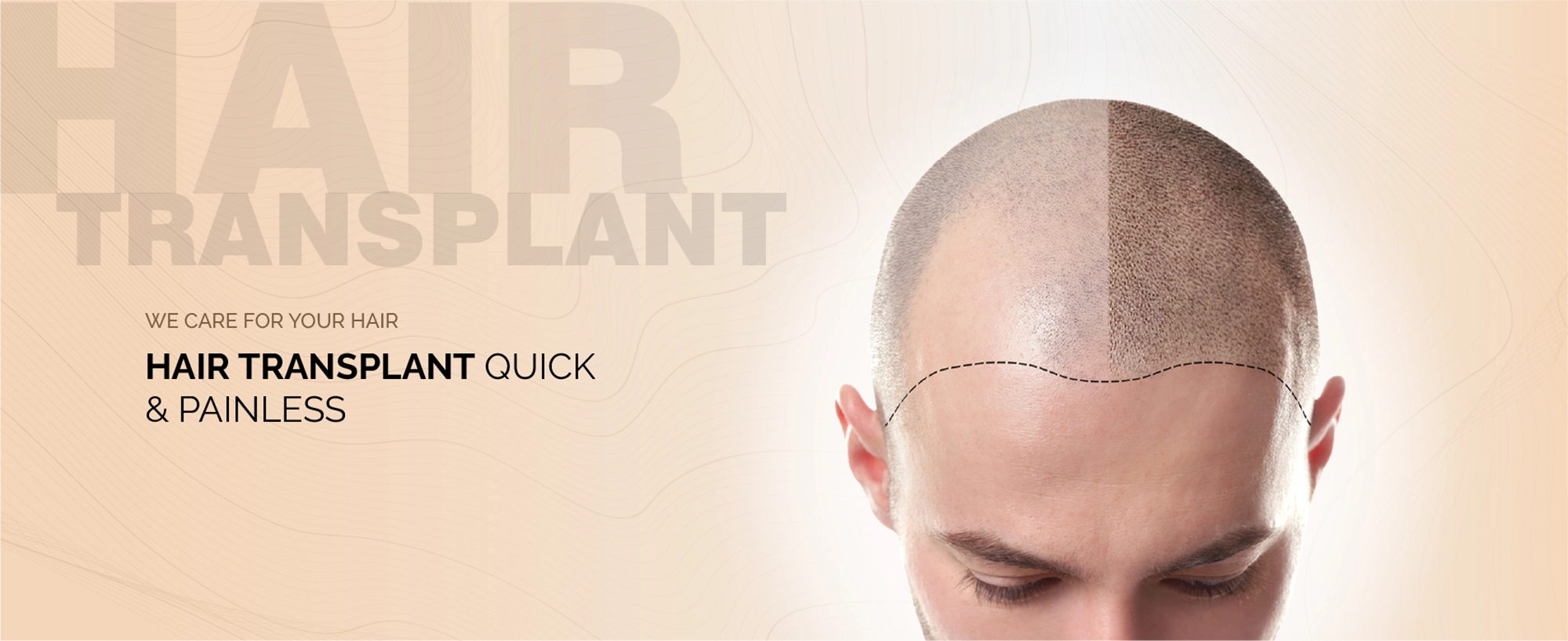 Pain Hair Procedure