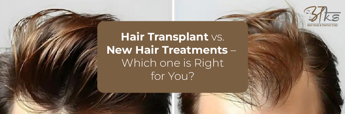 Hair Transplant vs New Hair Treatments - Which Option is Best