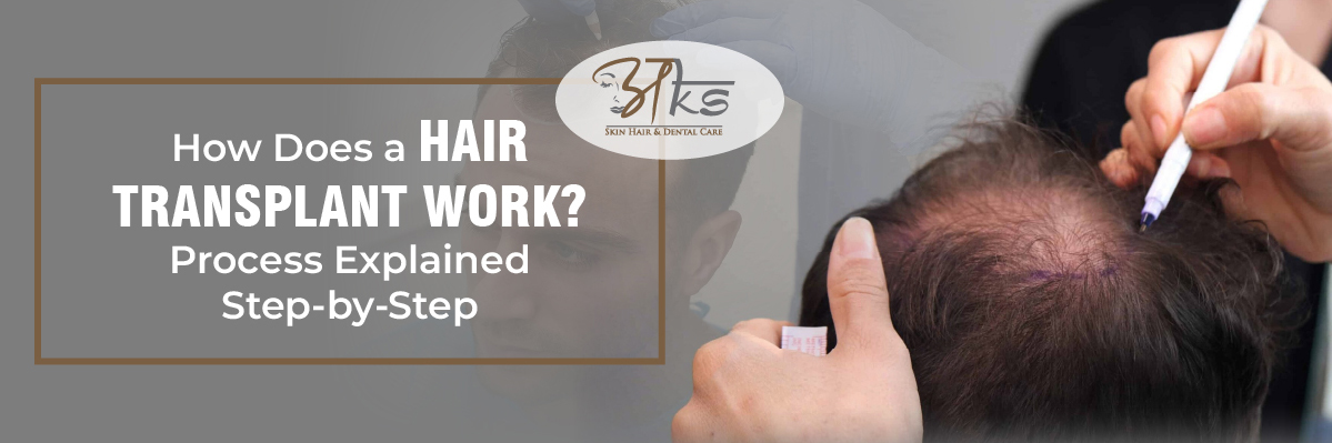 Hair Transplant works