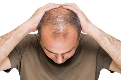 hair loss treatment in gurgaon