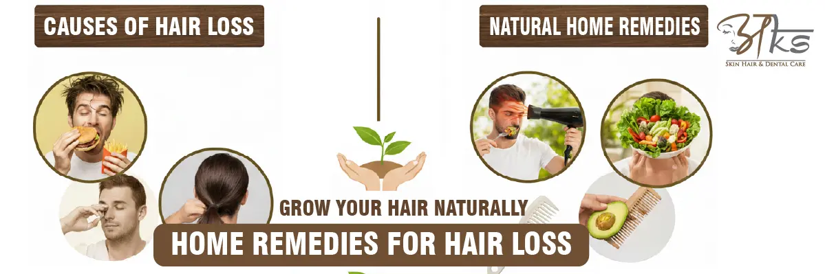 Home Remedies For Hair Loss