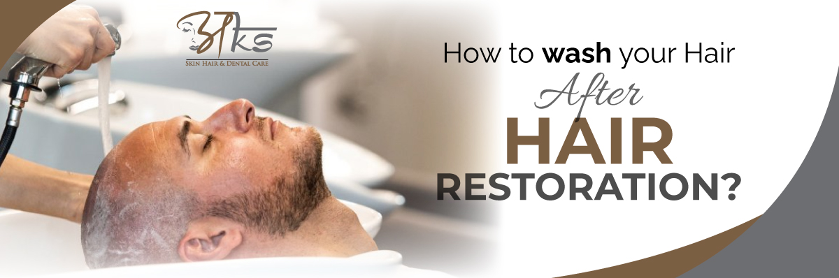 How to Wash Your Hair After Hair Restoration?
