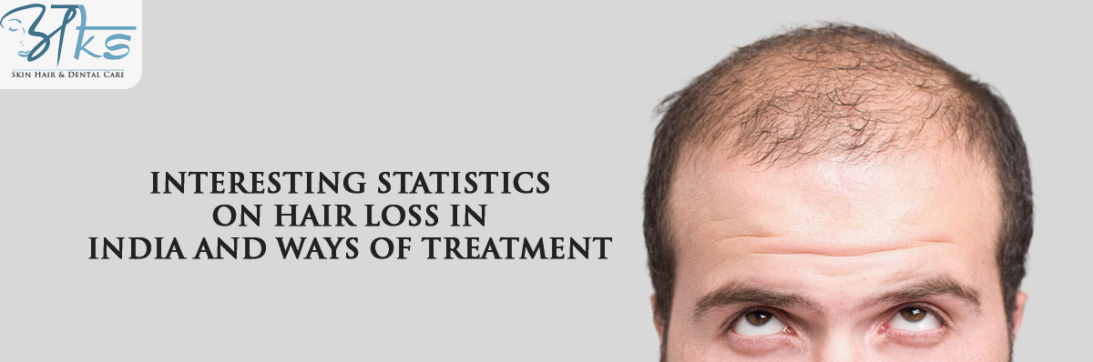hair loss in India and ways of treatment
