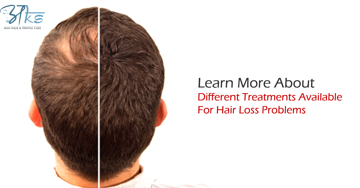 Treatments Available For Hair Loss Problems
