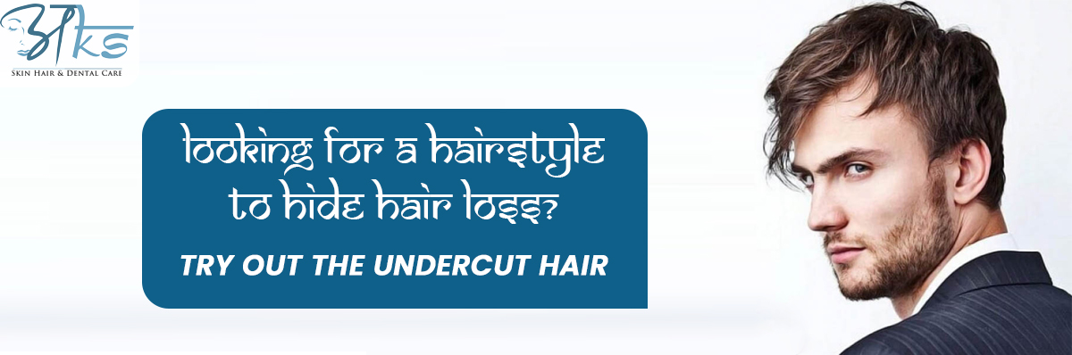 Looking for a hairstyle to hide hair loss? Try out the Undercut hair