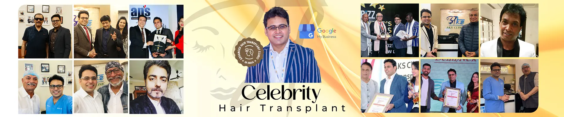 Celebrity Hair Transplant