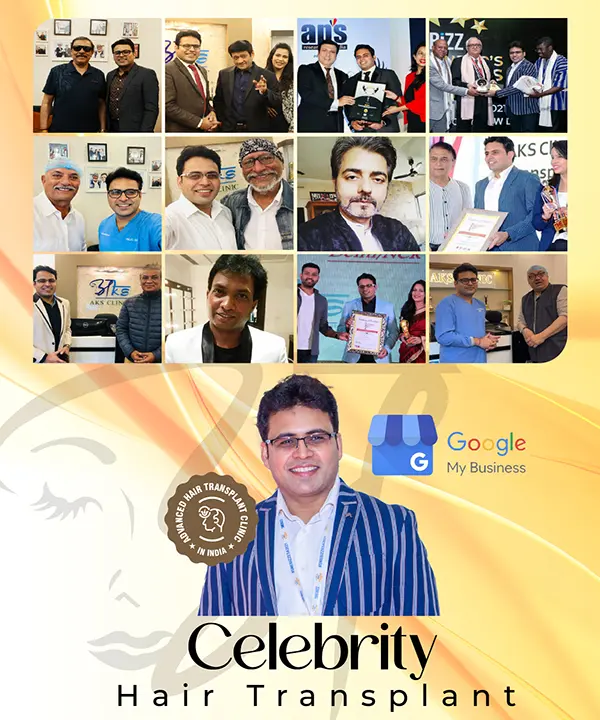 Celebrity Hair Transplant