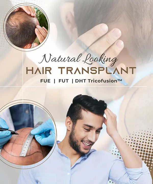 Natural Looking Hair Transplant
