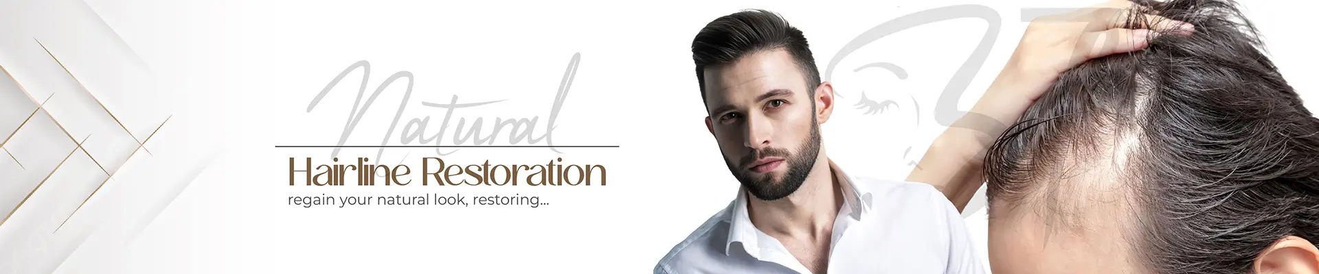 Natural Hairline Restoration