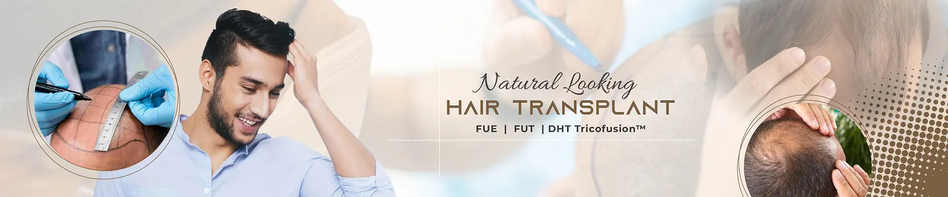 Natural Looking Hair Transplant