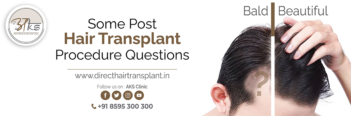Post Hair Transplant Procedures