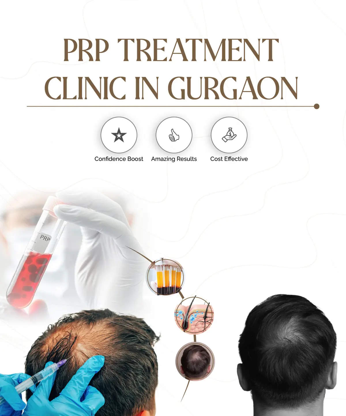 PRP Treatment Clinic for Hair Loss