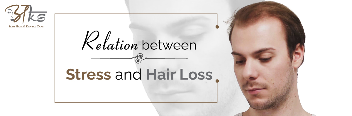 Relation Between Stress and Hair Loss