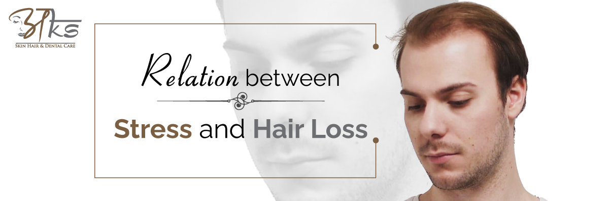 Hair transplant in Delhi