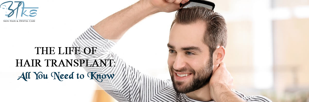 Life of Hair Transplant