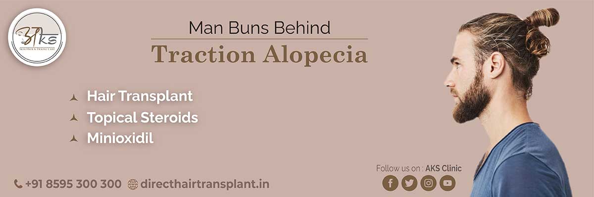 The Man’s Bun Behind the Tractional Alopecia