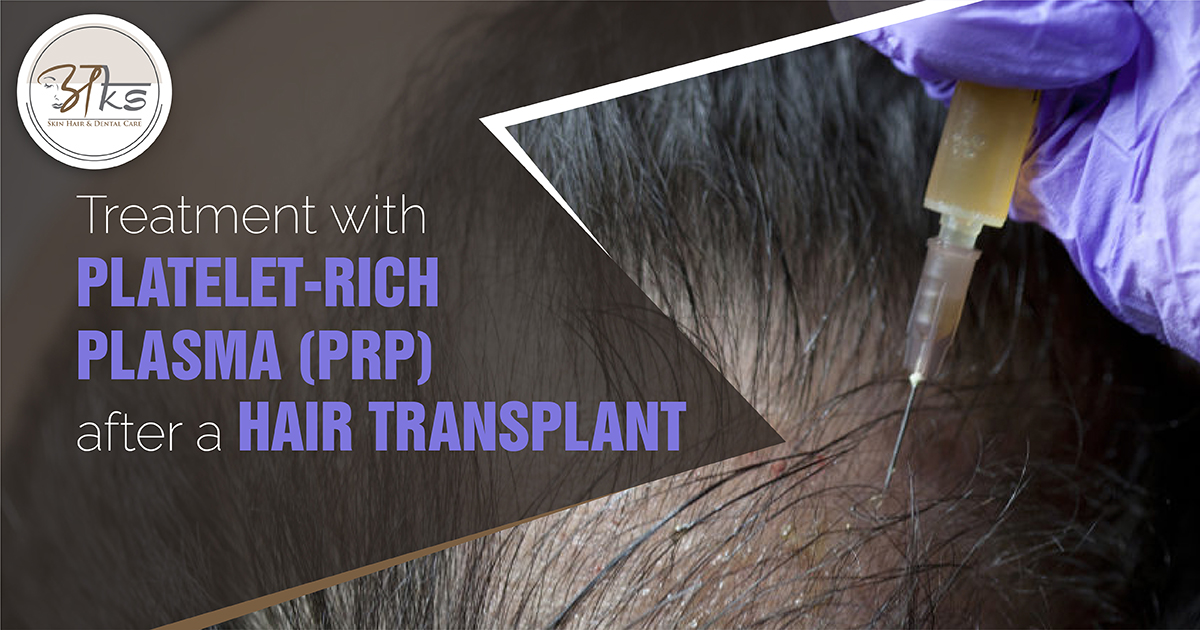 Treatment with Platelet-Rich Plasma (PRP) Therapy Gurgaon Treatment with Platelet-Rich Plasma (PRP) Therapy Gurgaon