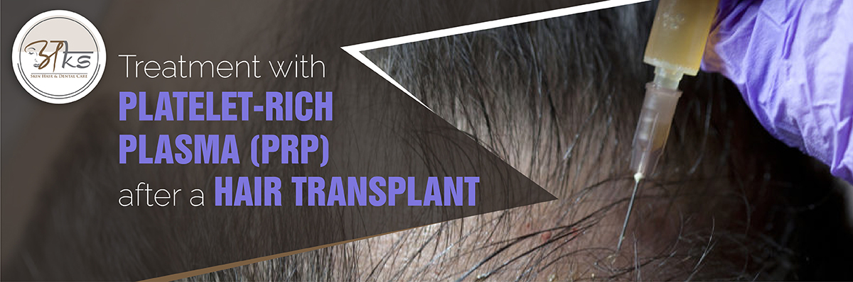 Know More Details About the Prp Therapy for Hair