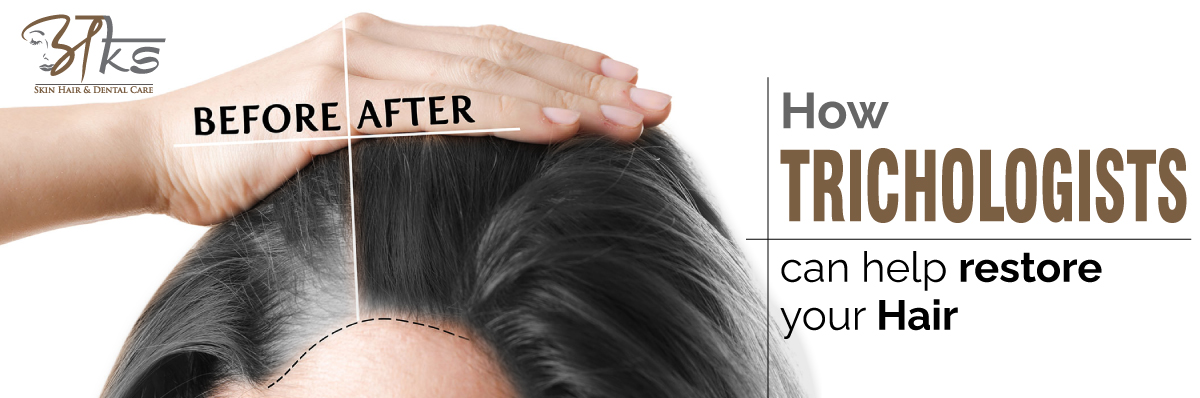 How Trichologists Can Help Restore your Hair