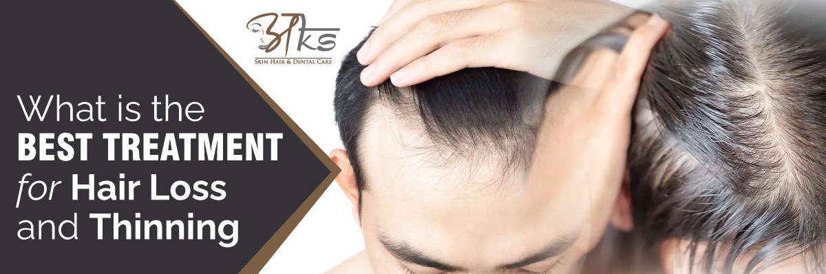 Hair transplant in Delhi