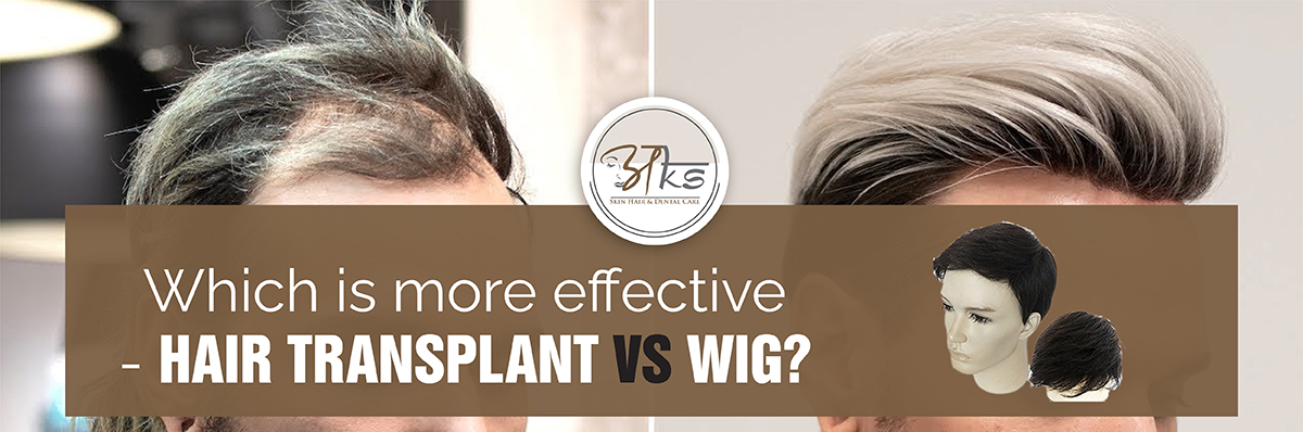 Which is more effective - Hair Transplant VS Wig - AKS Clinic