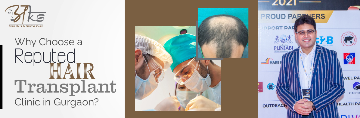 Why Choose a Reputed Hair Transplant Clinic in Gurgaon