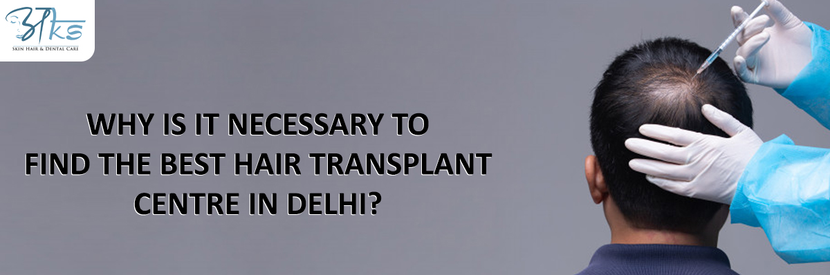  Best Hair Transplant Centre In Delhi