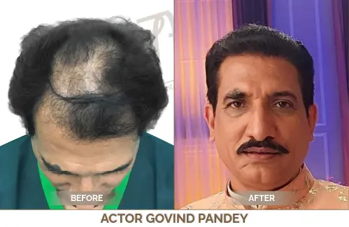 Celebrity Hair hair treatment Celebrity Hair TREATMENT
