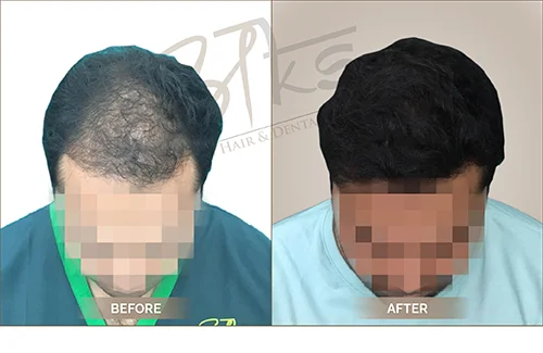 AKS clinic Before and After 9 AKS clinic Before and After 9